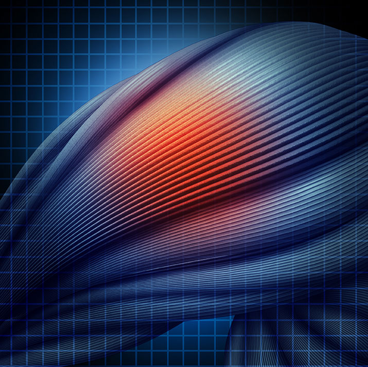 The efficacy of stem cell treatment for musculoskeletal conditions