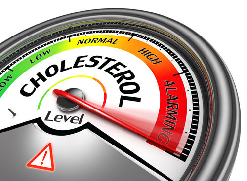 Stay on top of cholesterol screenings—it can save your life!