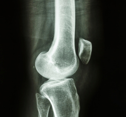 MA 0514 joint