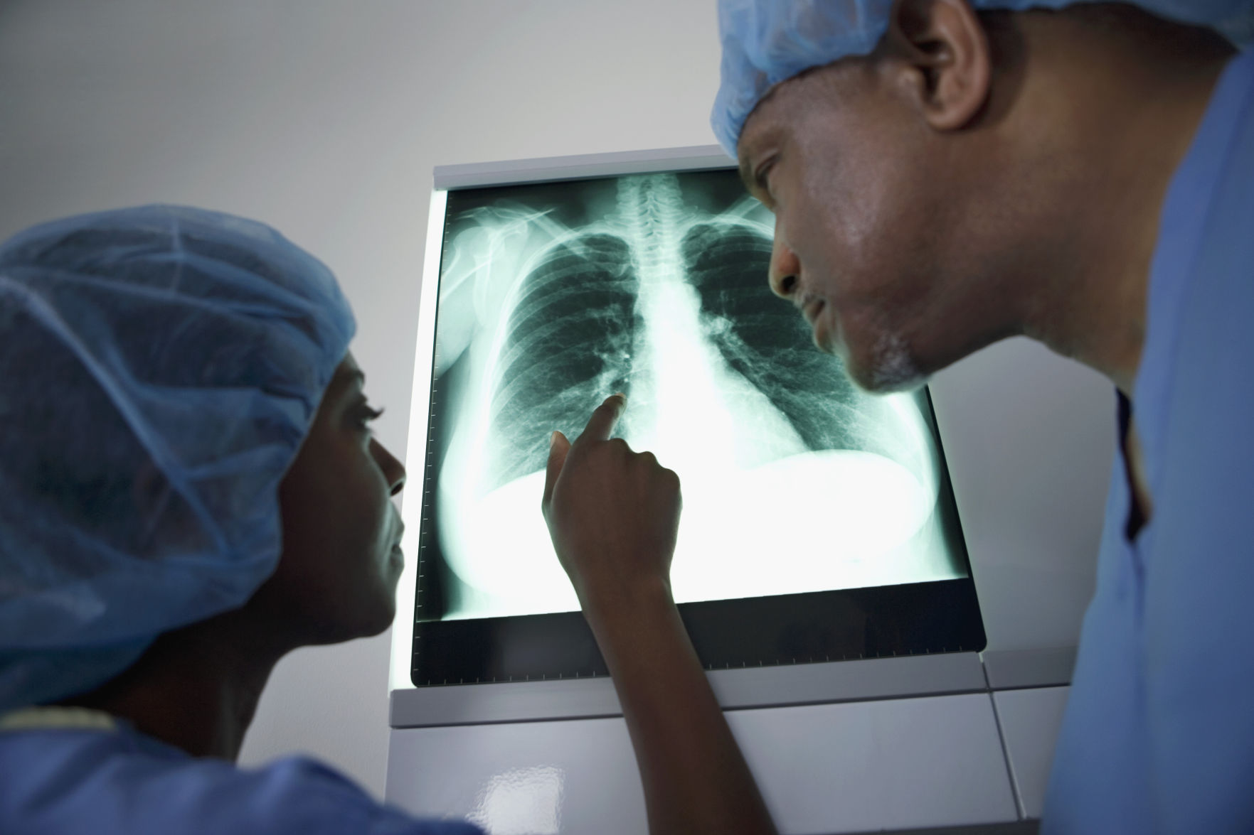 How non-smokers can reduce the risk of lung cancer